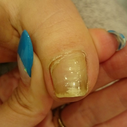 補正写真補正写真6-2